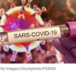 Ahli Virologi Bantah Prof Nidom soal COVID-19 Buatan: Ini Buatan Alam