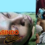 Memalukan!! Bukanya Berbuat Kebajikan di Hari Raya Idul Fitri Ini, Beberapa Pemuda Ngrawing Main Keroyok Terhadap 3 Pemuda Ngambak, Kini Berurusan Panjang dan Masuk Rumah Sakit